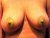 my golden nipples