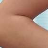 Uncovered poultice