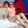 My Topless After Breast Operation